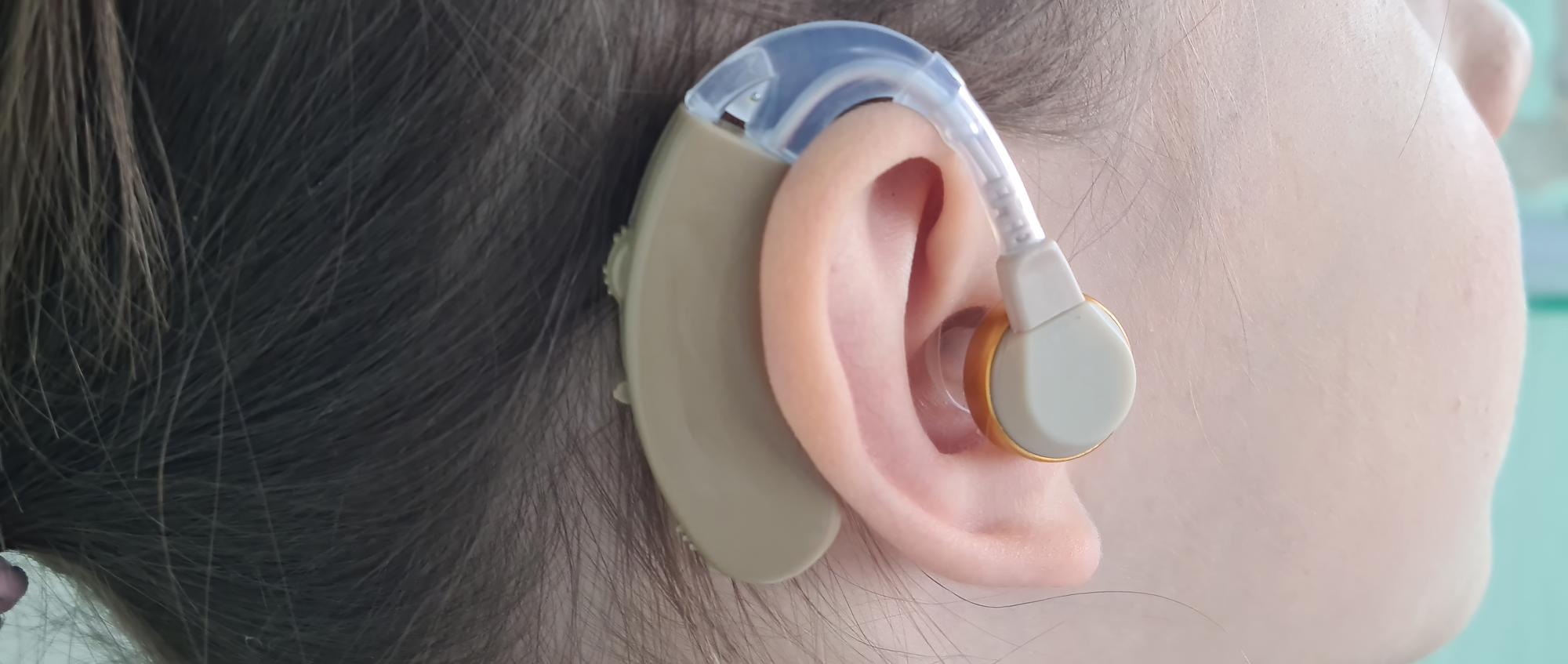 آیا همه کمشنواییها نیاز به سمعک دارند؟