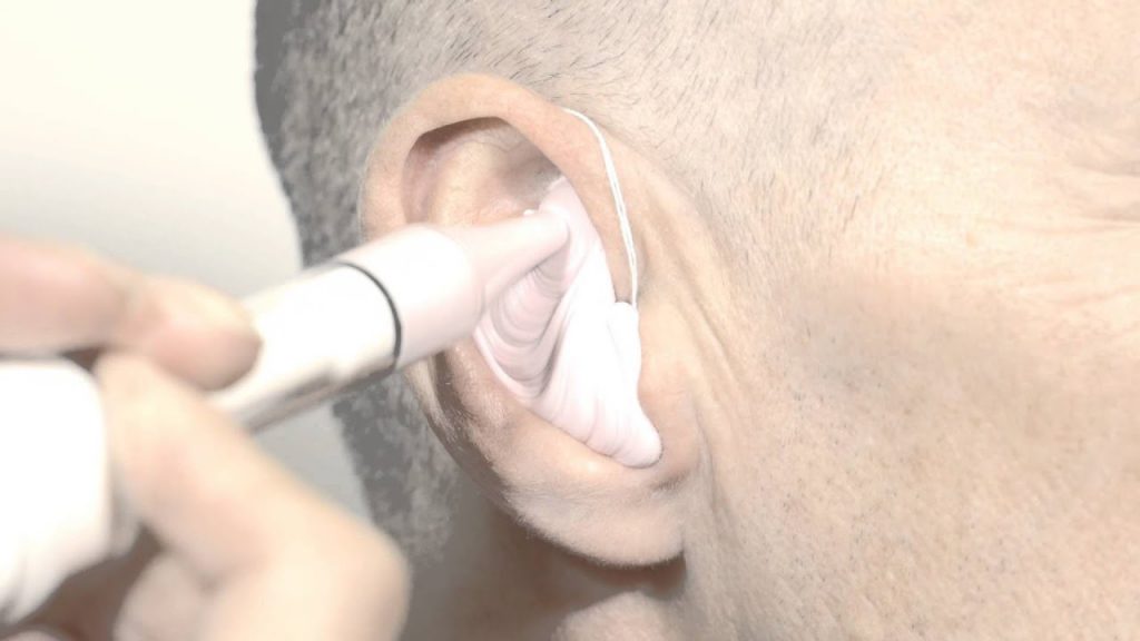 مزایا و محدودیتهای سمعک پشت گوشی در استفاده روزمره